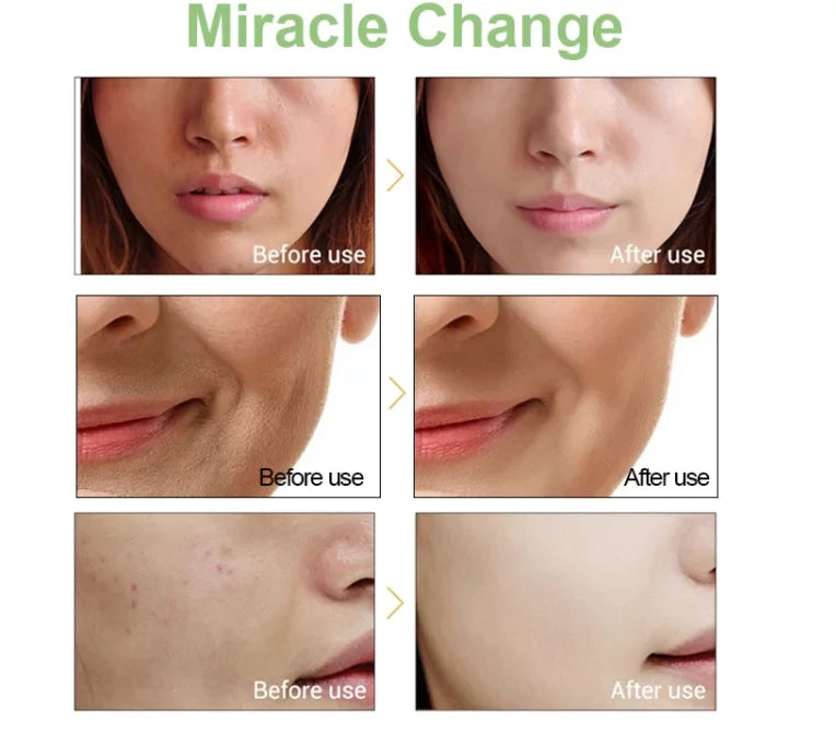 Anti And Wrinkle Reducing 2.5% Serum Aging Retinol